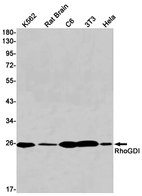 RhoGDI Rabbit mAb