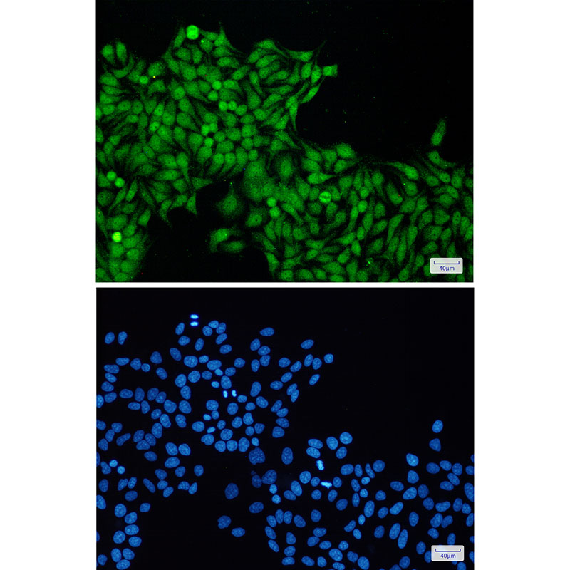 RBX1 Rabbit mAb