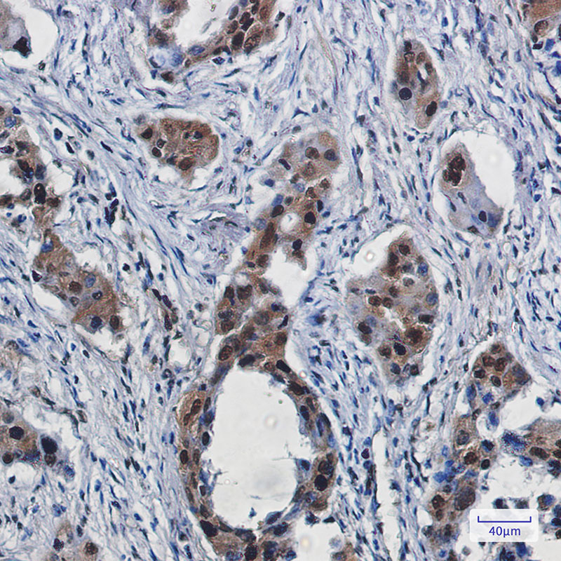 RBX1 Rabbit mAb