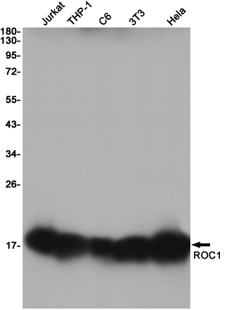 RBX1 Rabbit mAb