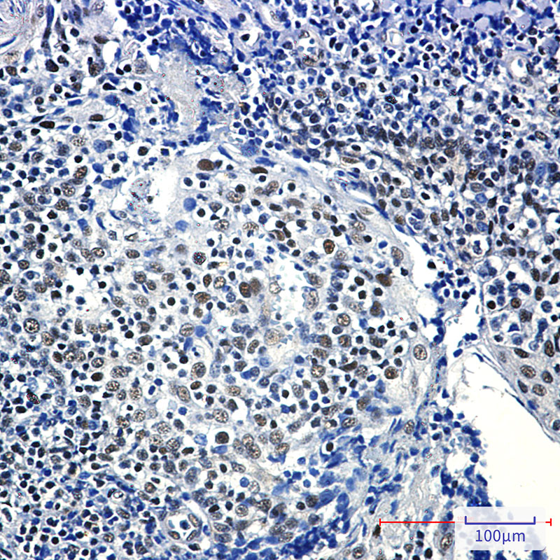 RPA32 Rabbit mAb