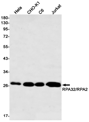 RPA32 Rabbit mAb