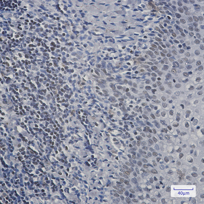 RPA32 Rabbit mAb