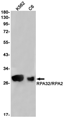 RPA32 Rabbit mAb