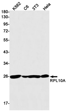 RPL10A Rabbit mAb