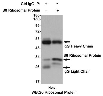 RPS6 Rabbit mAb