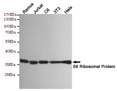 RPS6 Rabbit mAb