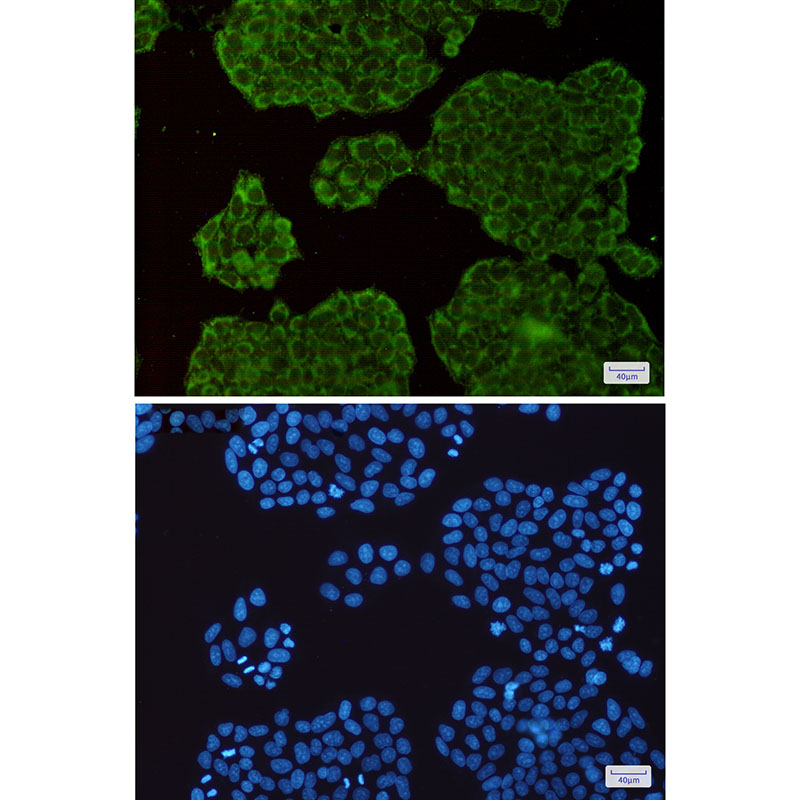 Exocyst Complex Component 3 Rabbit mAb