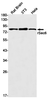 Exocyst Complex Component 3 Rabbit mAb