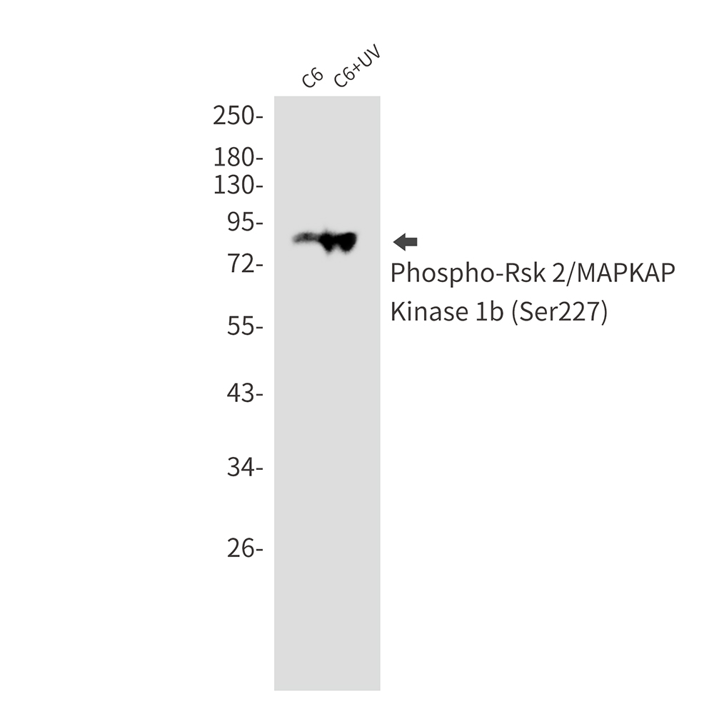 Phospho-RSK2 (Ser227) Rabbit mAb