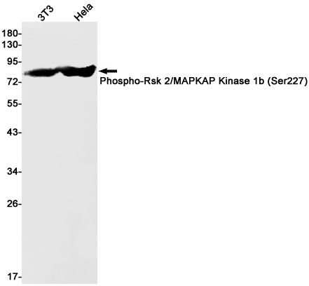 Phospho-RSK2 (Ser227) Rabbit mAb