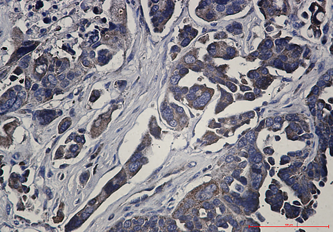 RSK1 p90 Rabbit mAb