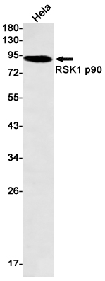 RSK1 p90 Rabbit mAb