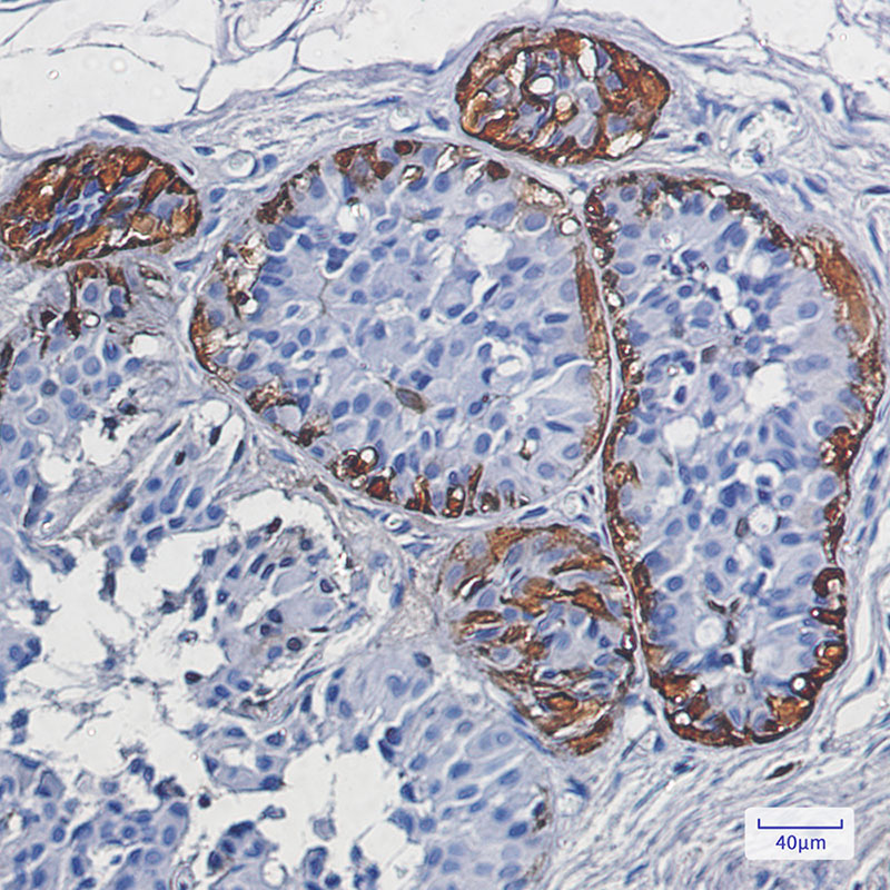 S100B Rabbit mAb