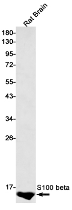 S100B Rabbit mAb