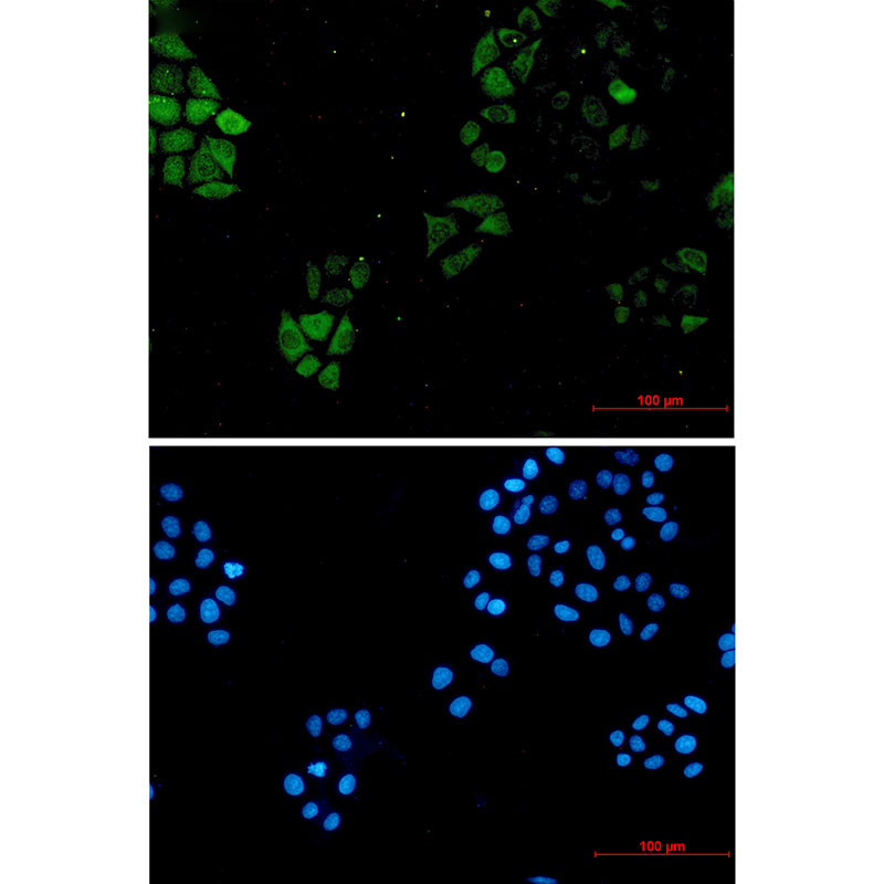 S100A4 Rabbit mAb