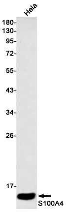 S100A4 Rabbit mAb