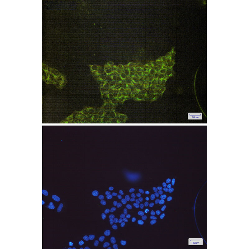 S6K1 Rabbit mAb