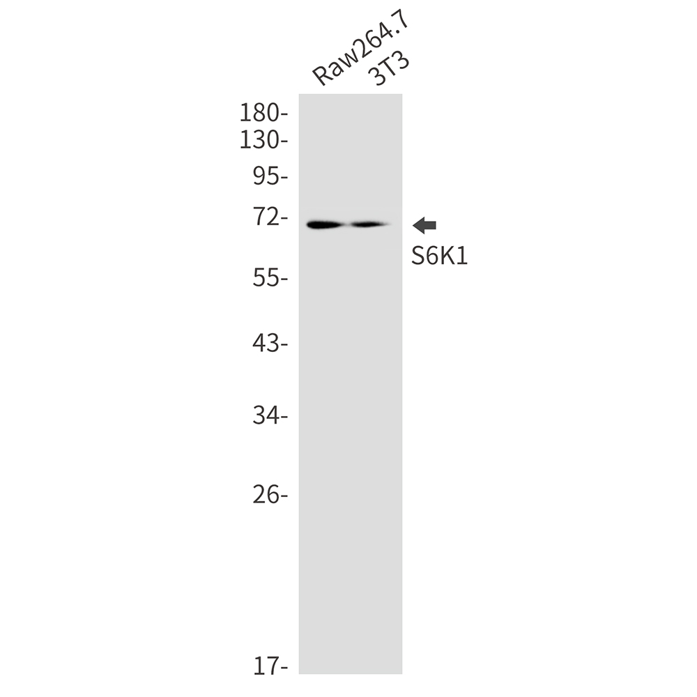 S6K1 Rabbit mAb