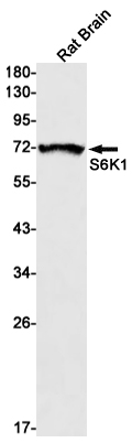 S6K1 Rabbit mAb