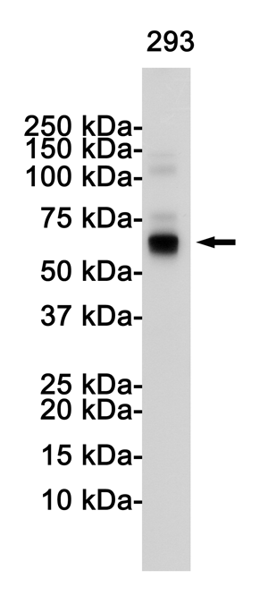 S6K1 Rabbit mAb