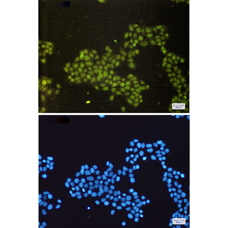 SAE1 Rabbit mAb