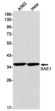 SAE1 Rabbit mAb