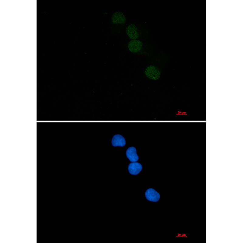 SAE1 Rabbit mAb