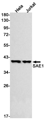 SAE1 Rabbit mAb