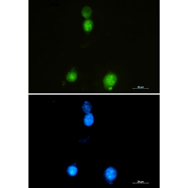 SAFB1 Rabbit mAb