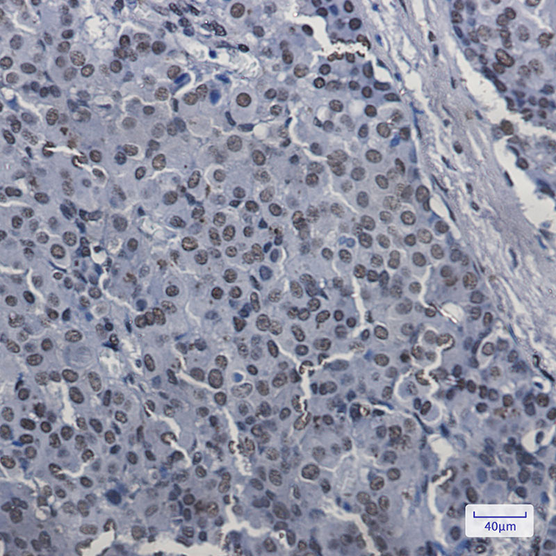 SAFB1 Rabbit mAb