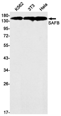 SAFB1 Rabbit mAb