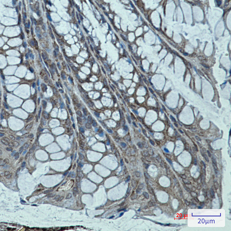 Sarcomeric alpha Actinin Rabbit mAb