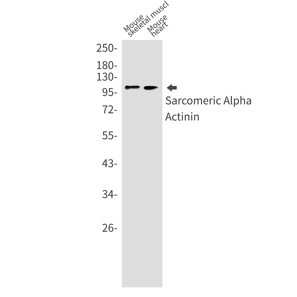 Sarcomeric alpha Actinin Rabbit mAb