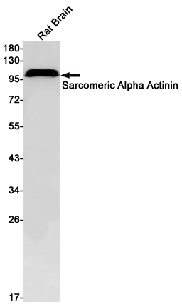 Sarcomeric alpha Actinin Rabbit mAb