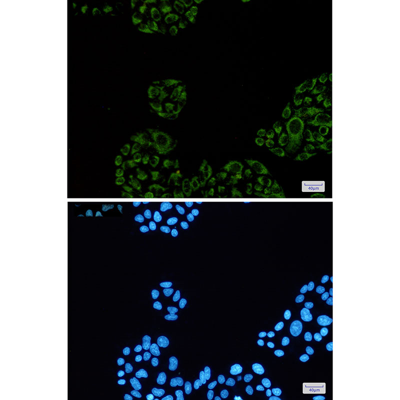 SDHA Rabbit mAb