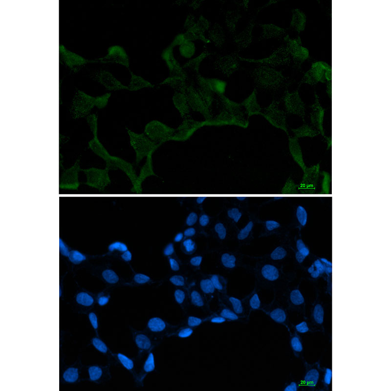 SF2 Rabbit mAb