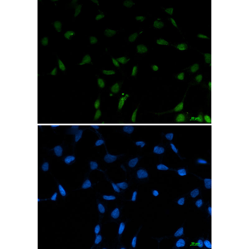 SFPQ Rabbit mAb