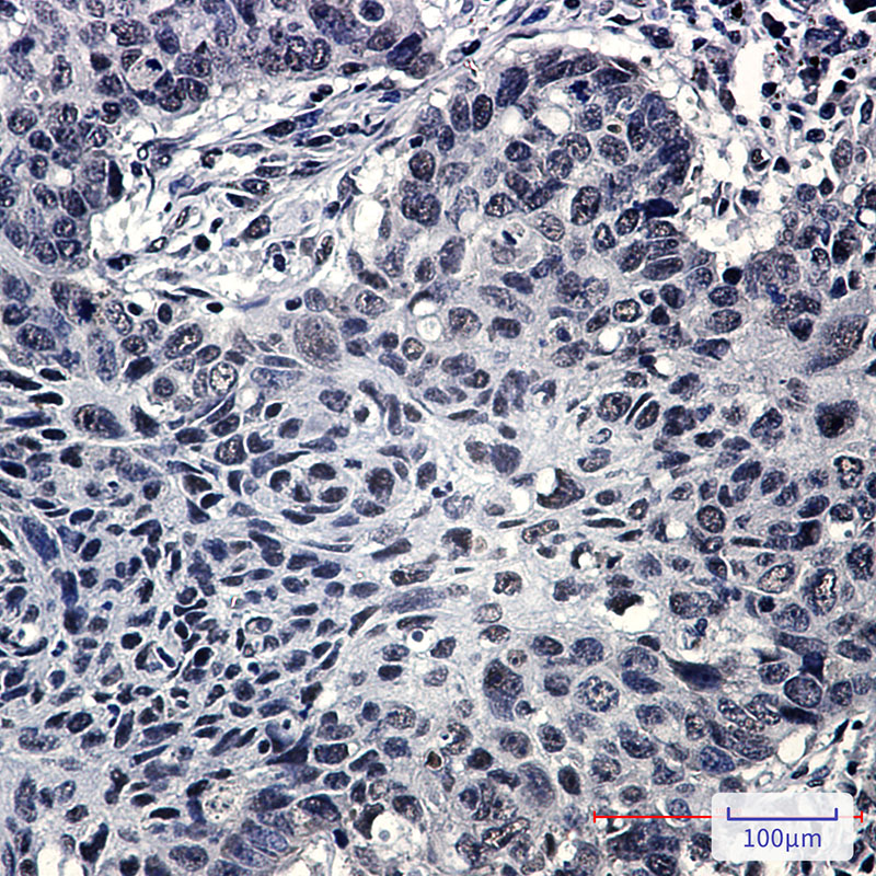 SRSF3 Rabbit mAb