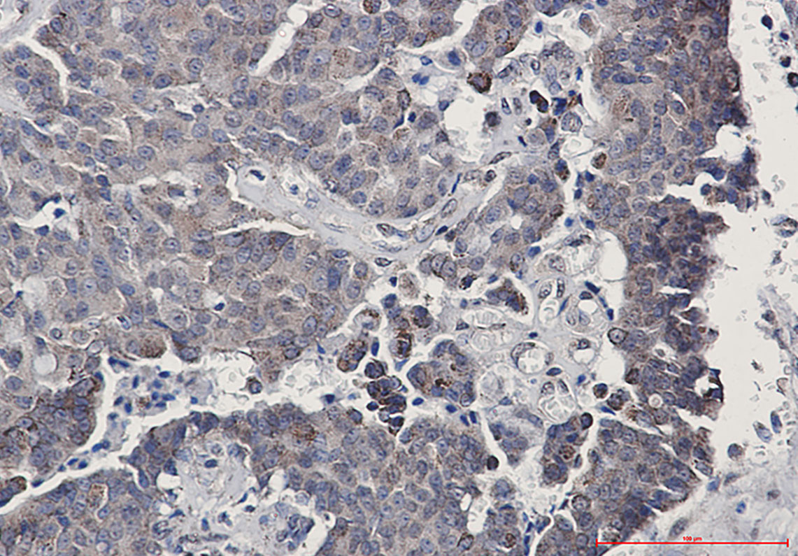 SIRT3 Rabbit mAb