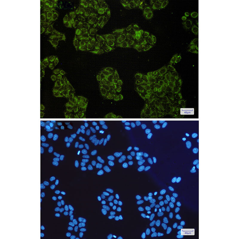 SMAC Rabbit mAb