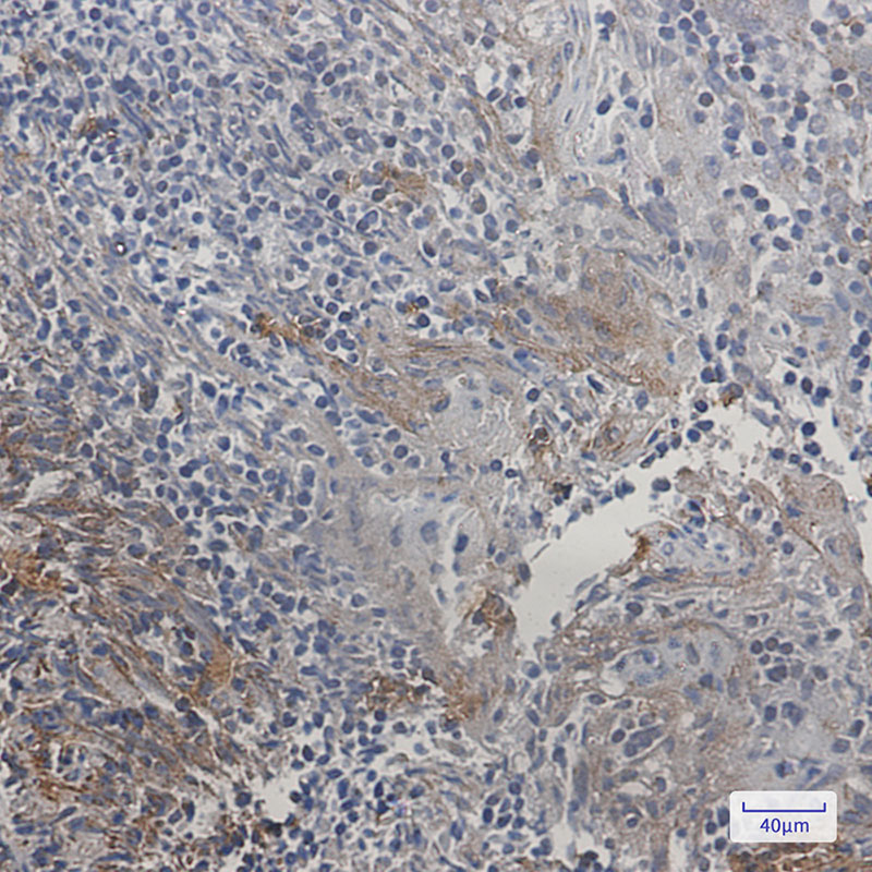 SMAC Rabbit mAb