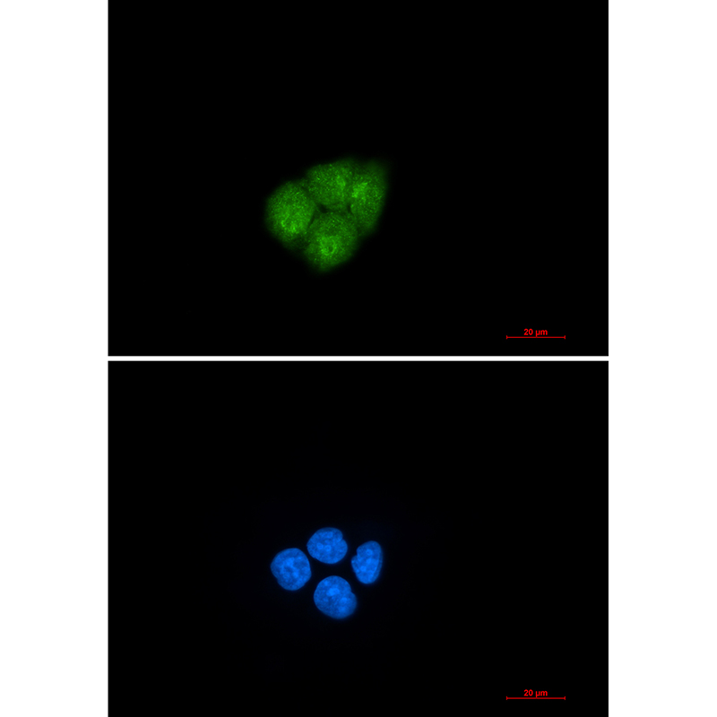 Smad2 Rabbit mAb