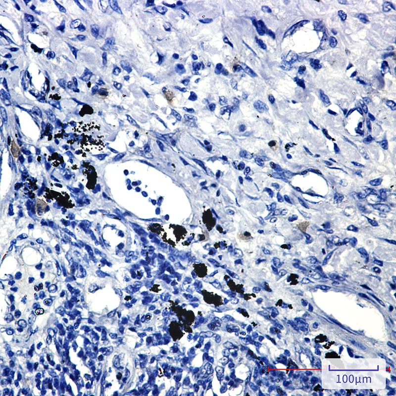 Smad2 Rabbit mAb