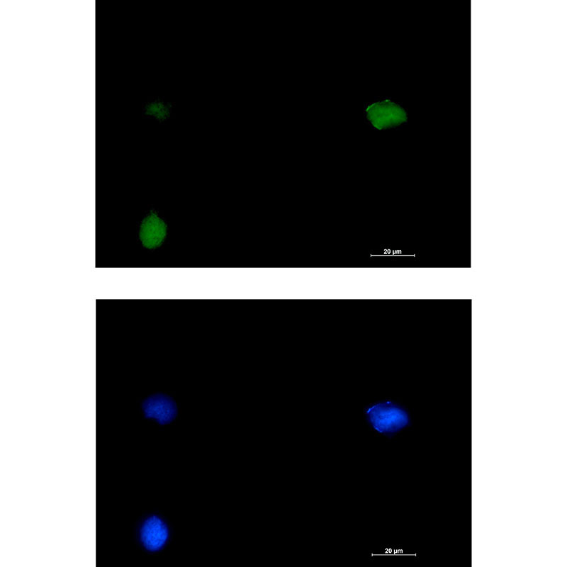 SMARCC1 Rabbit mAb