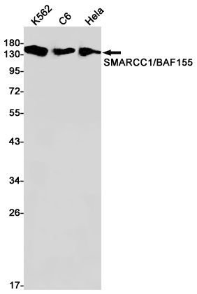 SMARCC1 Rabbit mAb