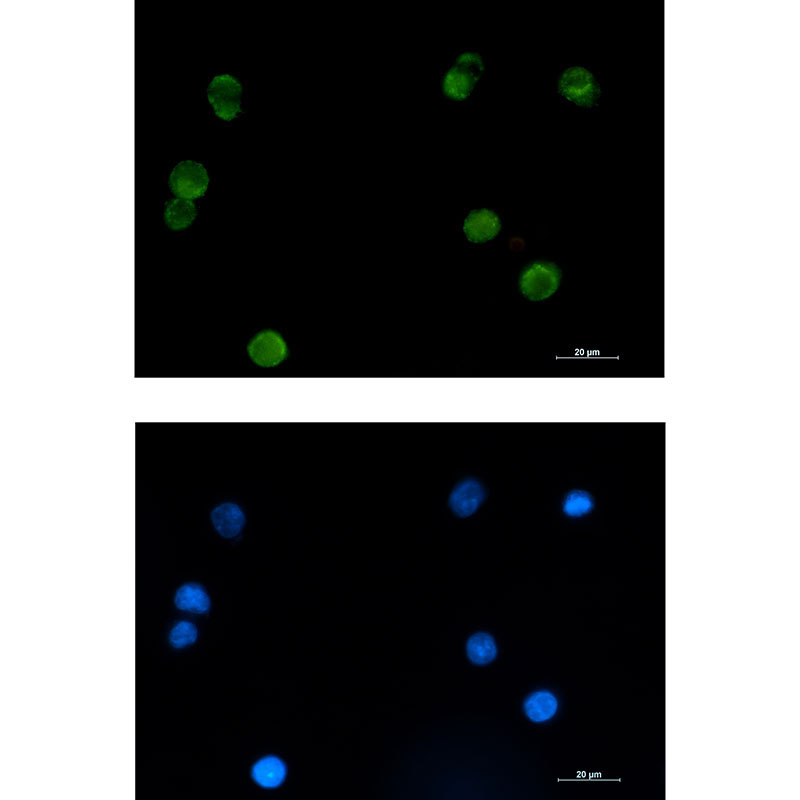 SMYD3 Rabbit mAb