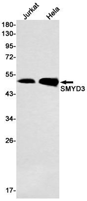 SMYD3 Rabbit mAb