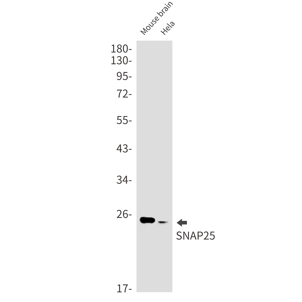 SNAP25 Rabbit mAb