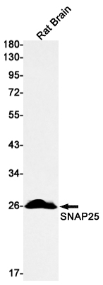 SNAP25 Rabbit mAb